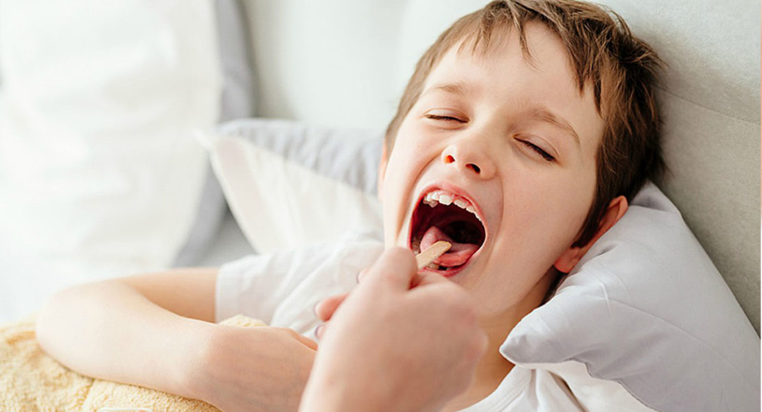 Qué es bueno para la laringitis en niños