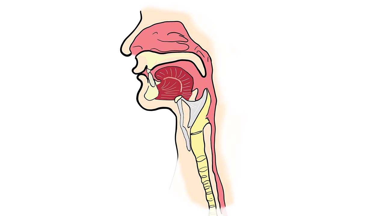 tumores benignos en la laringe